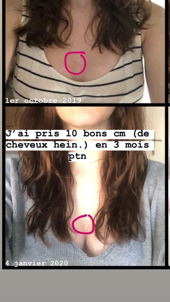 Deux photos comparatives avant/après, la première datée du 1er mars 2019 et la seconde du 6 janvier 2020, avec le texte : « J...
