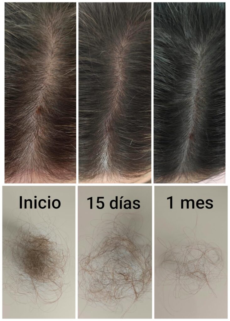 Images avant/après montrant l'évolution des cheveux et de la chute. Le texte est en espagnol.
