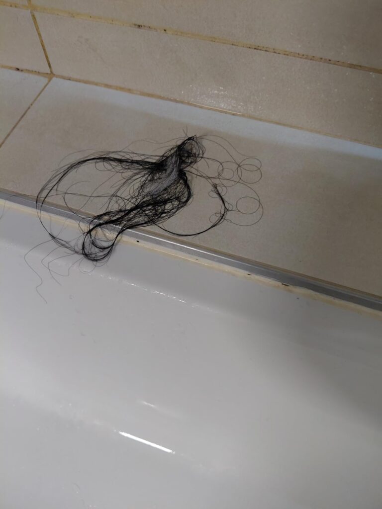 Cheveux tombés dans une douche, illustrant la perte de cheveux avant traitement.