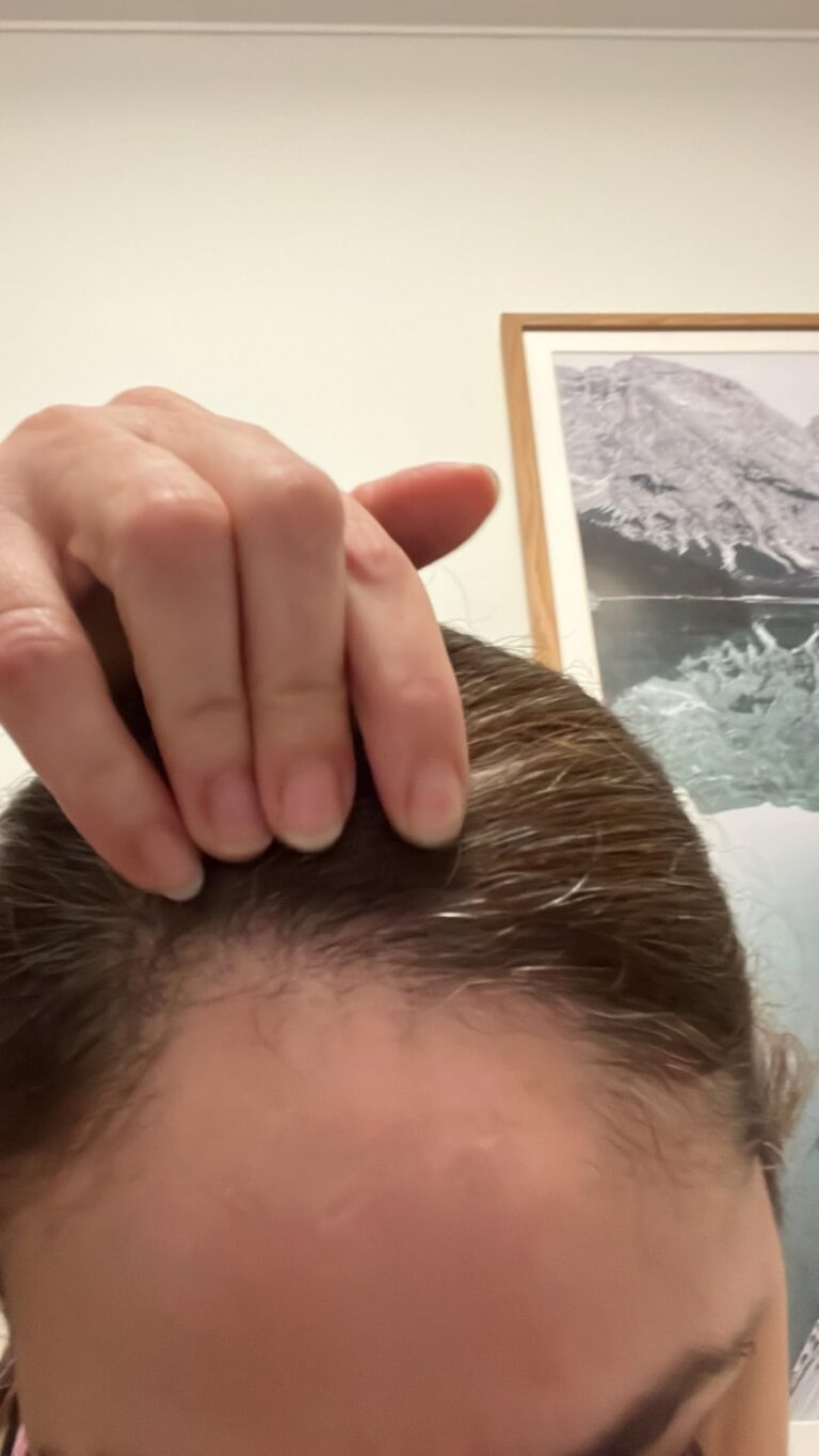 Gros plan sur une personne qui soulève ses cheveux pour montrer la repousse de ses racines.
